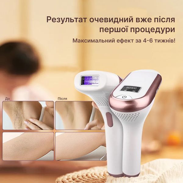 Фотоепілятор IPL Hair Removal Device з ручкою White (BZ-0721) BZ-0721 фото